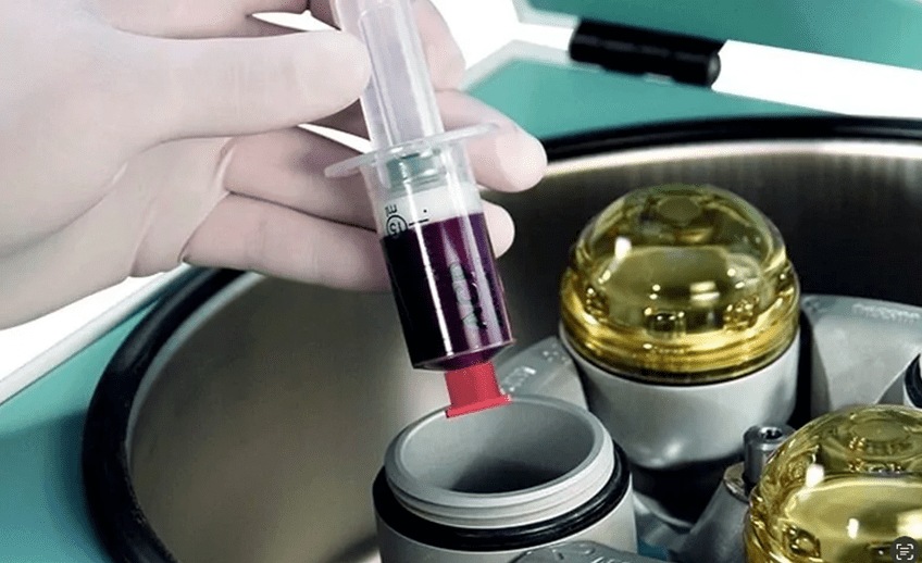 Für die Eigenbluttherapie wird Blut aus dem Arm entnommen.